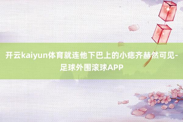 开云kaiyun体育就连他下巴上的小痣齐赫然可见-足球外围滚球APP